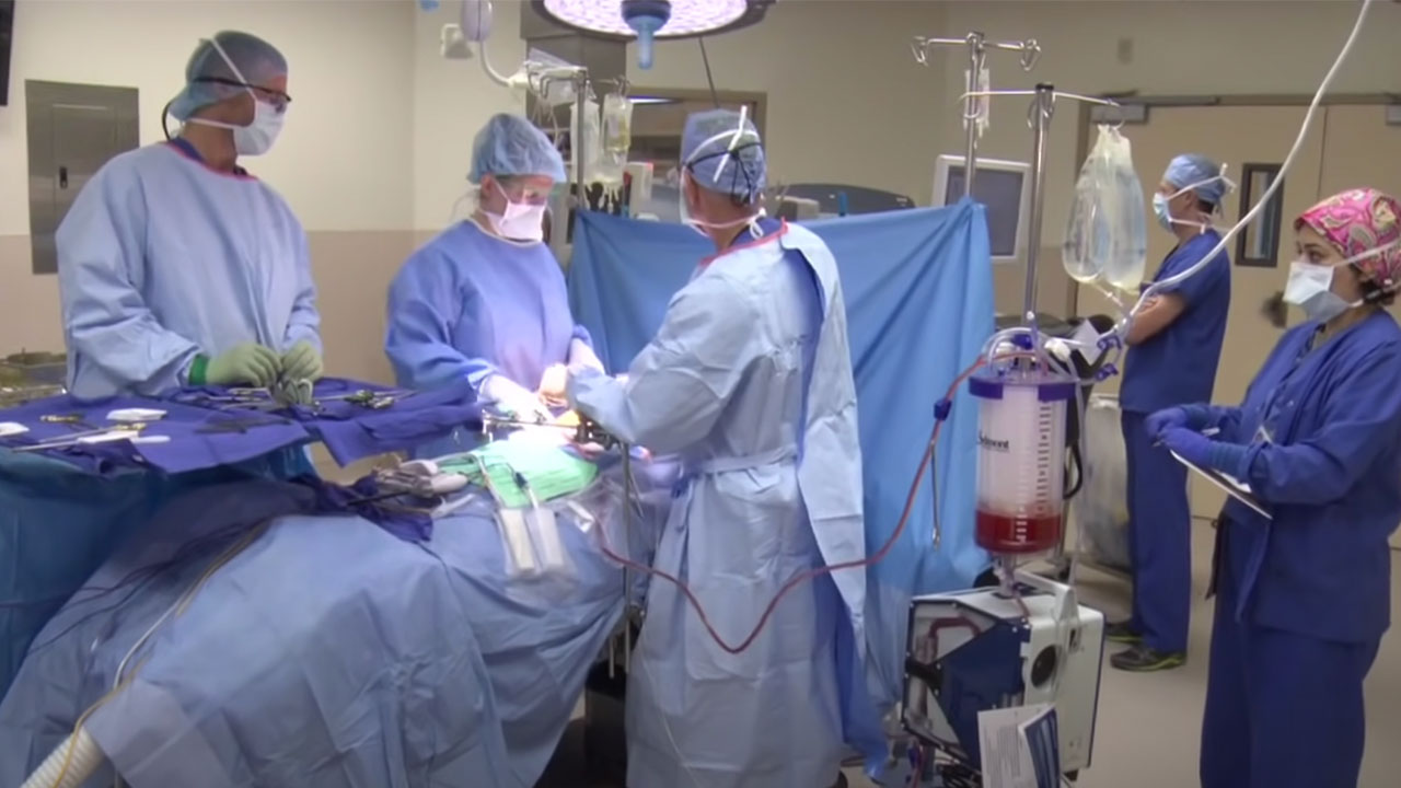 three doctors do surgery on a patient while a nurse stands by at right and another doctor watches a computer monitor